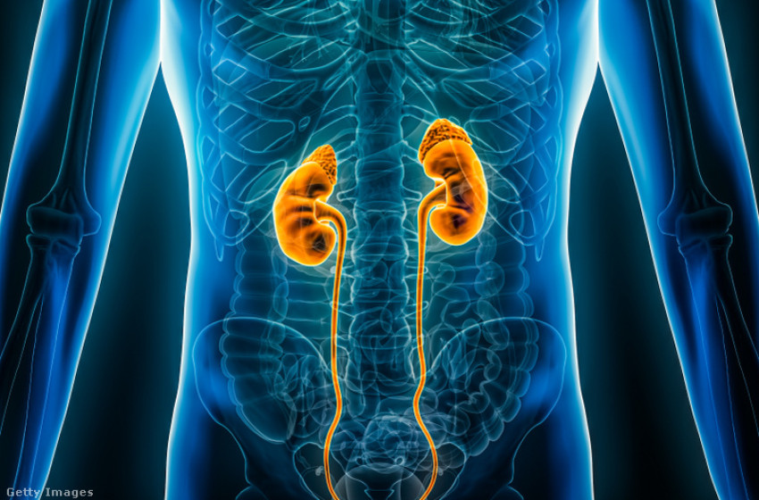 Akár már napi egy adag is tönkreteheti a veséjét, ha ebből az italból iszik