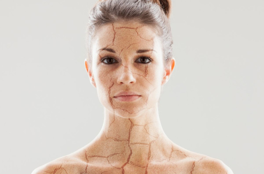 Száraz a bőröd? Ezeket az ételeket és italokat mindenképp kerüld el!