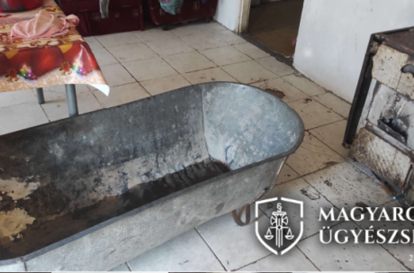 Életveszélyes égési sérüléseket szenvedett egy hároméves kislány, miután kicsaptak a lángok a megbuherált vaskályhából